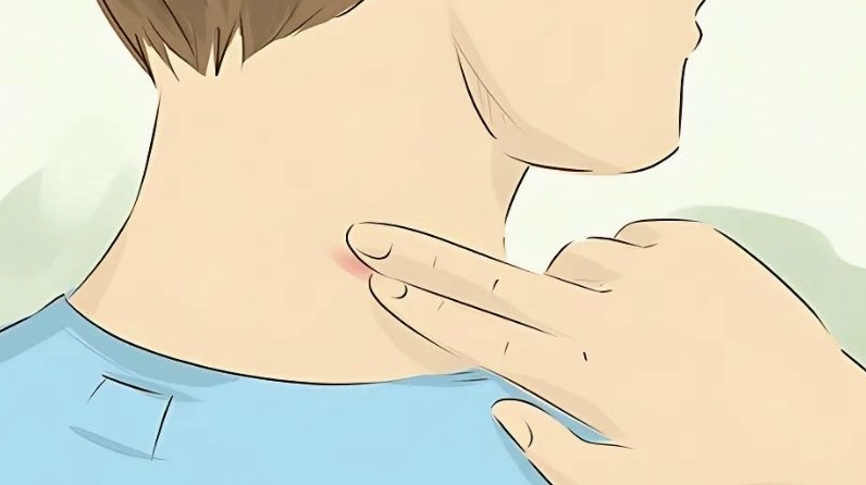 Massage quanh vết hickey có thể giúp tăng tuần hoàn máu