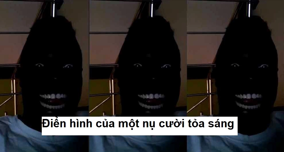 Meme cười chỉ thấy răng