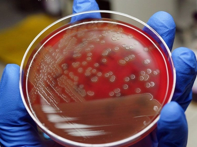 Nhuộm gram có thể xác định được loại vi khuẩn gram âm hay gram dương nhanh hơn phương pháp nuôi cấy