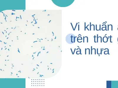 Thớt tưởng sạch nhưng đầy vi khuẩn- Cách xử lý triệt để
